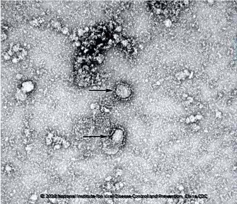 First electron microscopic images of the novel coronavirus in China